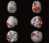 BF-7 복용에 의한 학습·기억력 향상효과; 기억력·학습력 담당 뇌부위가 활성화 됨 (노란색 및 붉은색)-1