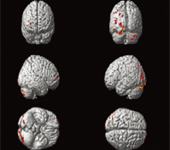 BF-7 복용에 의한 학습·기억력 향상효과; 기억력·학습력 담당 뇌부위가 활성화 됨 (노란색 및 붉은색)-2