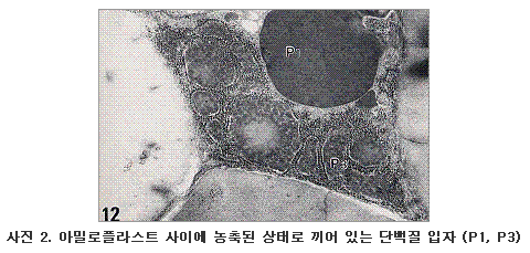 아밀로플라스트 사이에 농축된 상태로 끼어 있는 단백질 입자 (P1, P3)