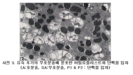 유숙 후기의 부호분층에 분포한 아밀로플라스트와 단백질 입자